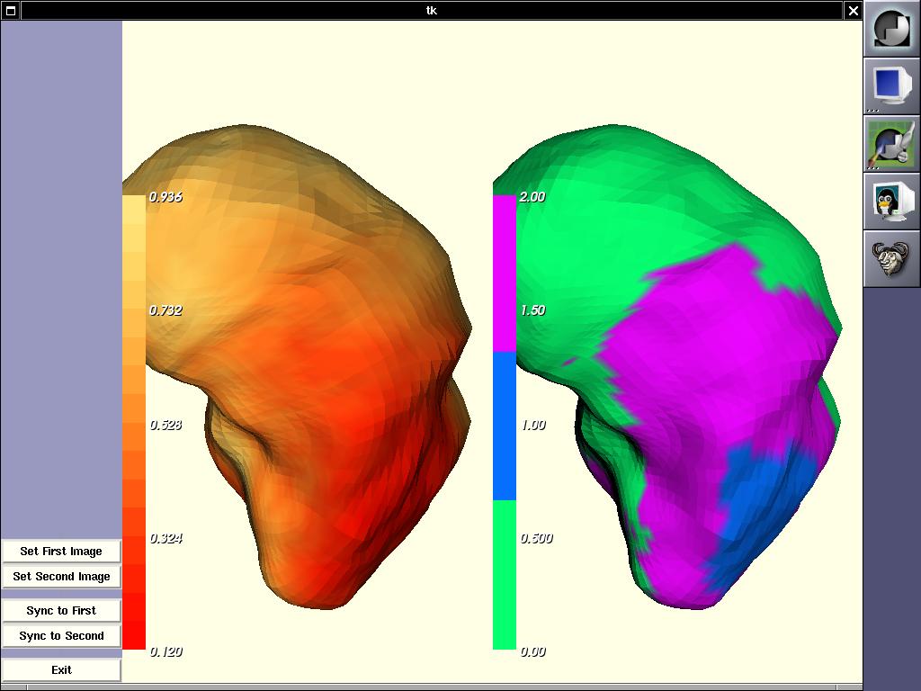 Visualizing Image Metrics on the Surface