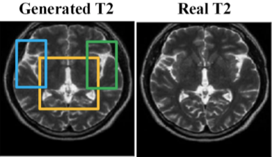 Generated T2 MRI next to the real T2