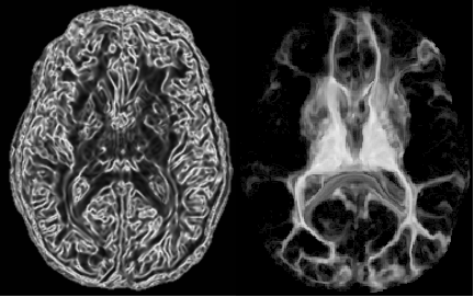 Knutsson edgemap and thalamo-cortical connectivity for an example brain