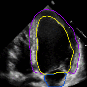 Left ventricle and atrial segmentation for four chamber echocardiography