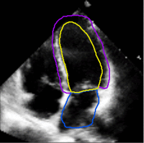 Left ventricle and atrial segmentation for four chamber echocardiography