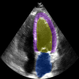Left ventricle and atrial segmentation for four chamber echocardiography