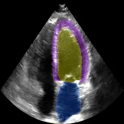 Left ventricle and atrial segmentation for four-chamber echocardiography