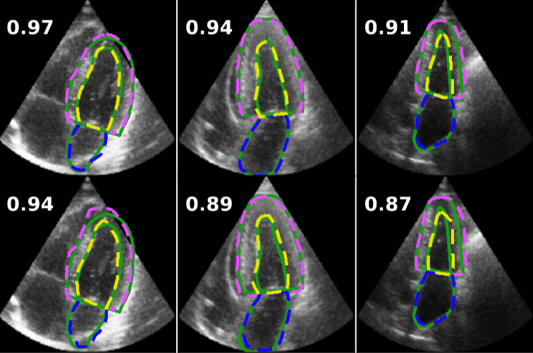 Bayesian-optimized cardiac segmentation compared with a published model